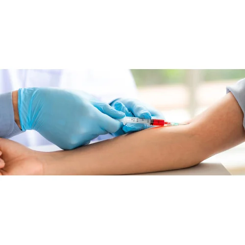 CD4 Testing